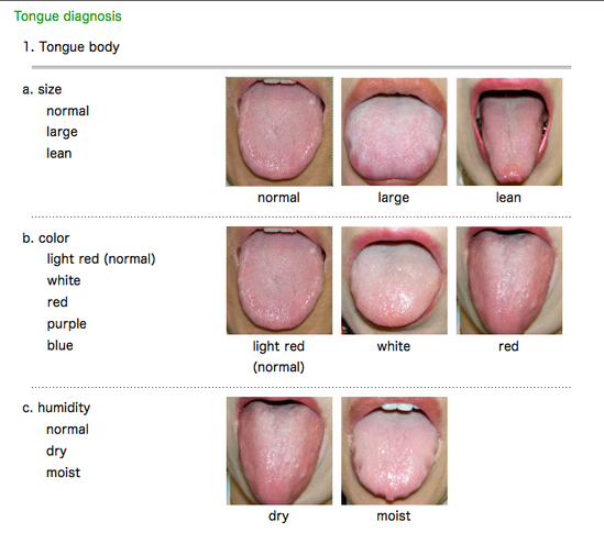 Tongue Color Diagnosis Chart